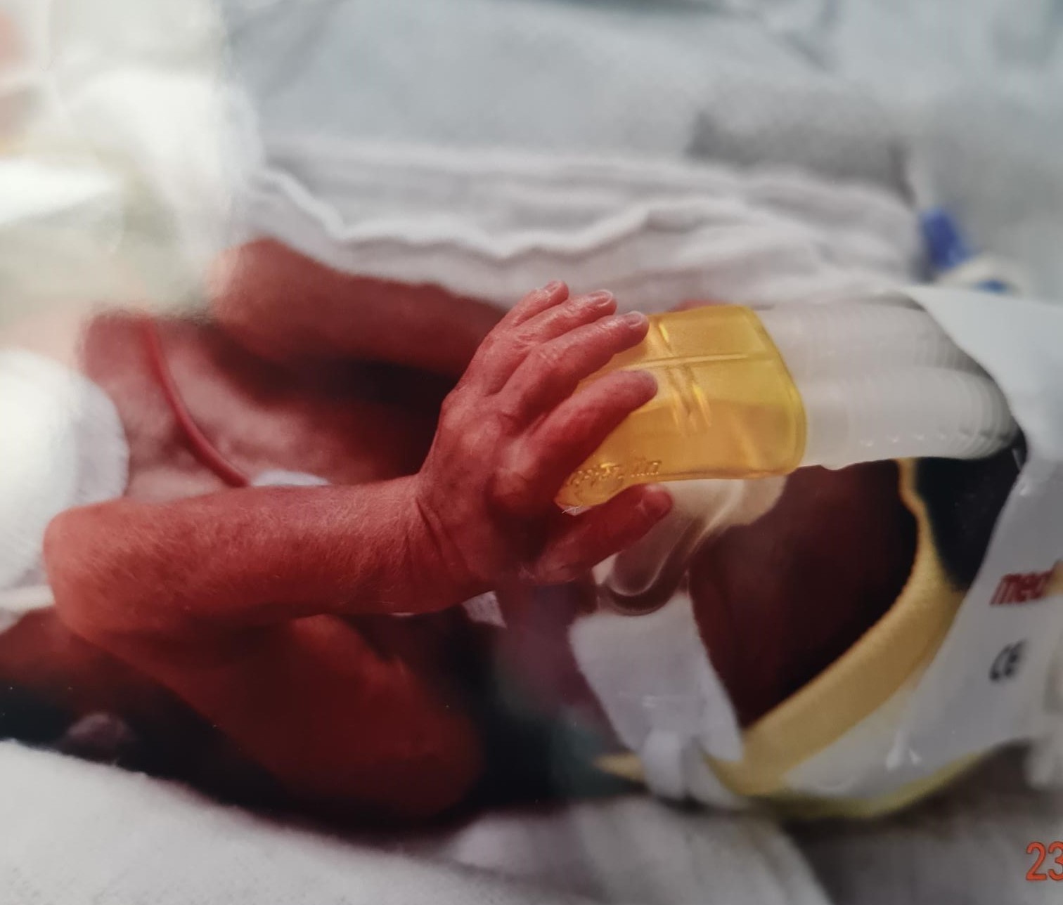 Die winzige Hand eines extrem frühgeborenen Babys im Inkubator