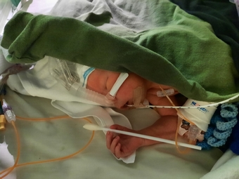 Foto aus dem Erfahrungsbericht «SSW 34+3»
